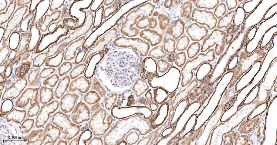 线粒体外膜受体Tom20重组兔单抗