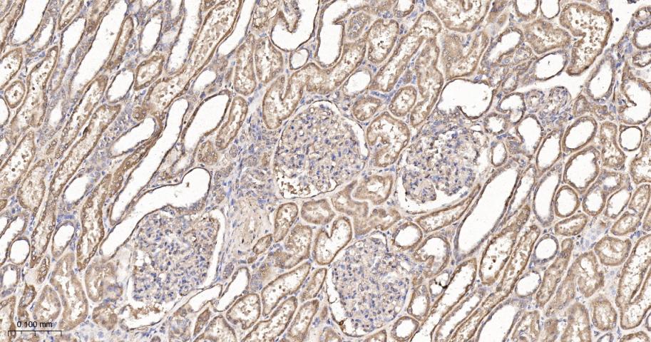SH2结构域转化蛋白1重组兔单抗-bsm-61677R