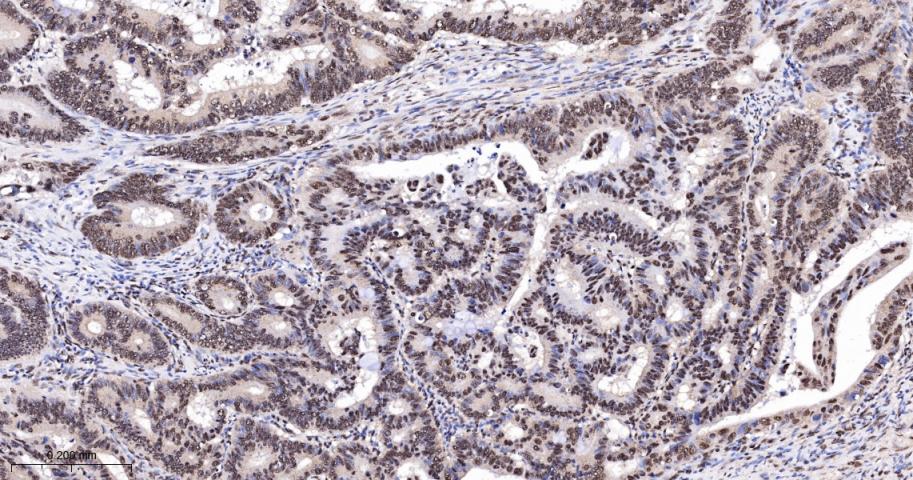 周期素E重组兔单抗