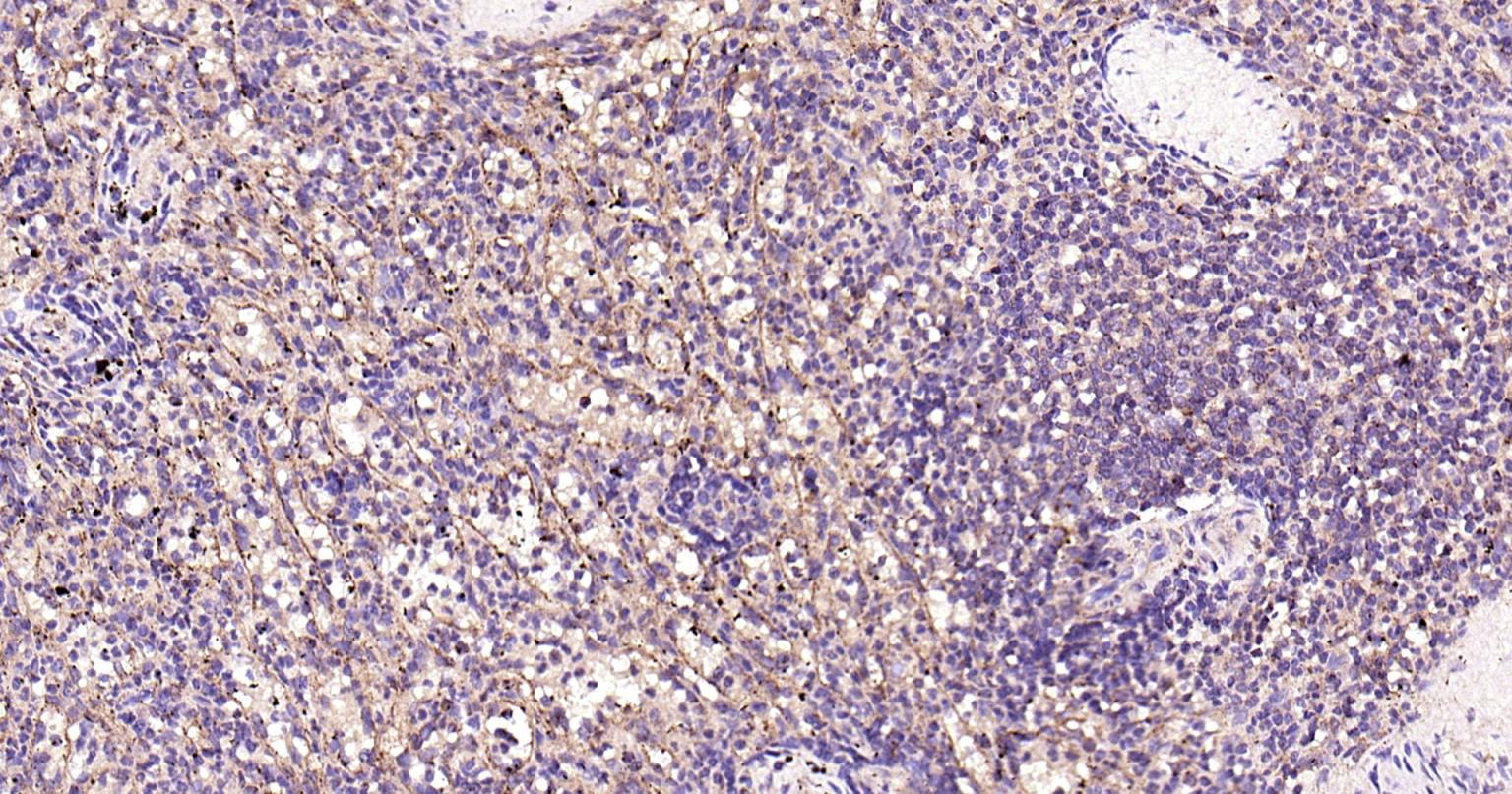 溶酶体相关膜蛋白1（CD107）单克隆抗体-bsm-51301M