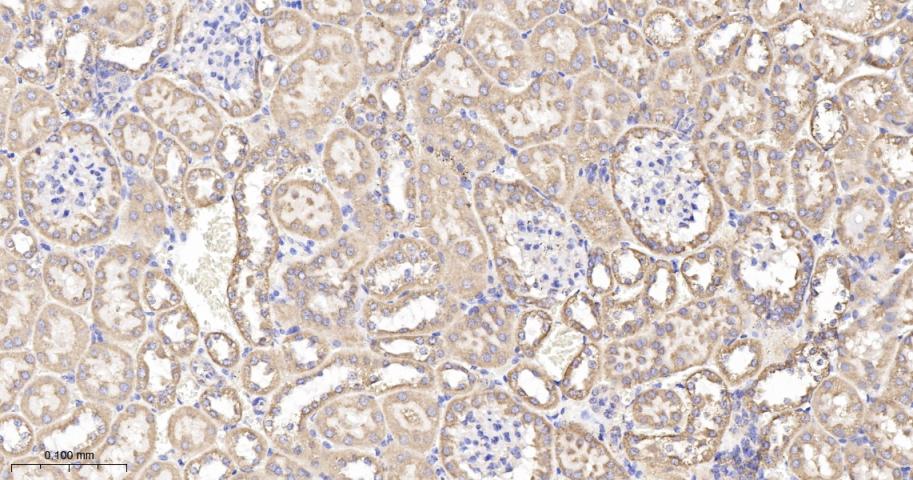 线粒体外膜受体Tom20重组兔单抗