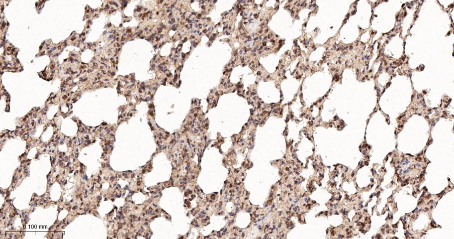 SH2结构域转化蛋白1重组兔单抗-bsm-61677R