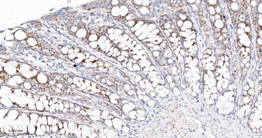 线粒体外膜受体Tom20重组兔单抗