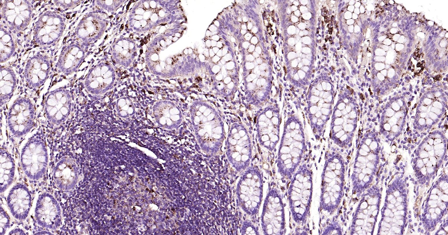 溶酶体相关膜蛋白1（CD107）单克隆抗体-bsm-51301M