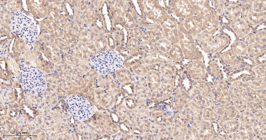 SH2结构域转化蛋白1重组兔单抗-bsm-61677R