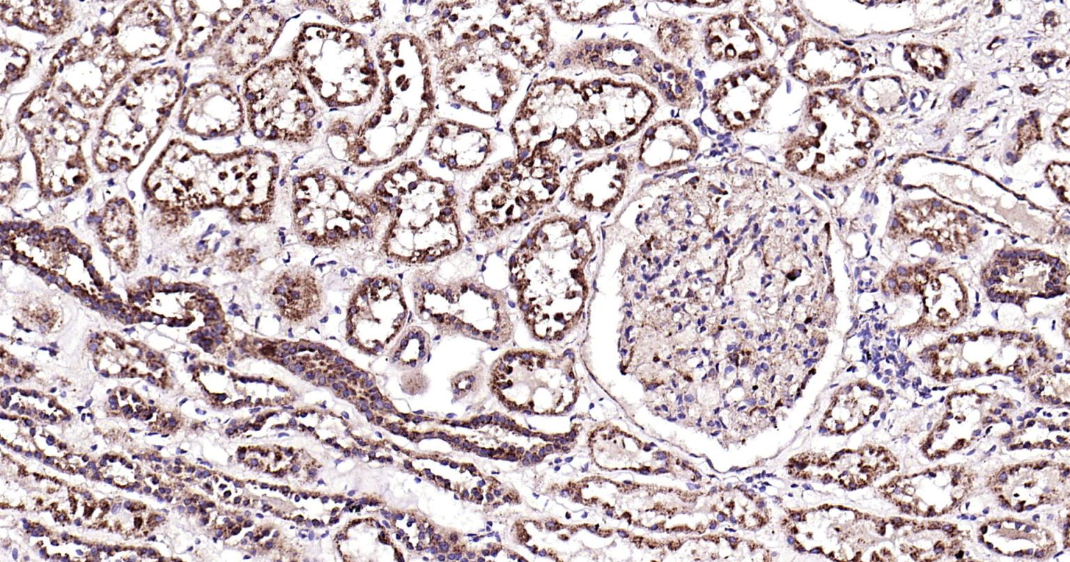 溶酶体相关膜蛋白1（CD107）单克隆抗体-bsm-51301M
