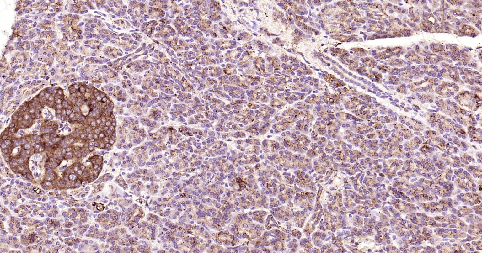 溶酶体相关膜蛋白1（CD107）单克隆抗体-bsm-51301M