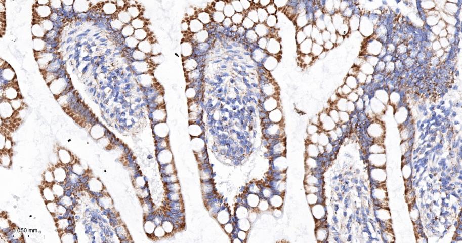 线粒体外膜受体Tom20重组兔单抗
