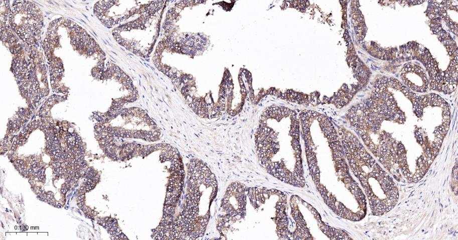 相关死亡促进因子BAD重组兔单抗