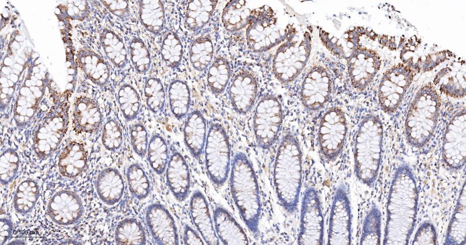 线粒体外膜受体Tom20重组兔单抗