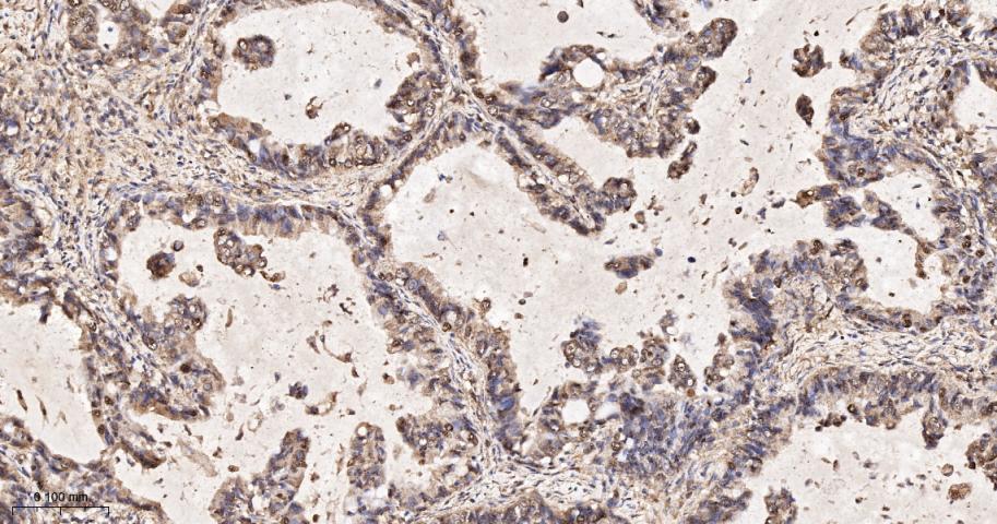 SH2结构域转化蛋白1重组兔单抗-bsm-61677R