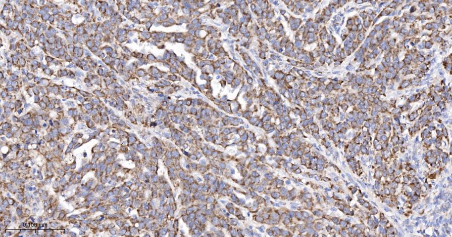 线粒体外膜受体Tom20重组兔单抗