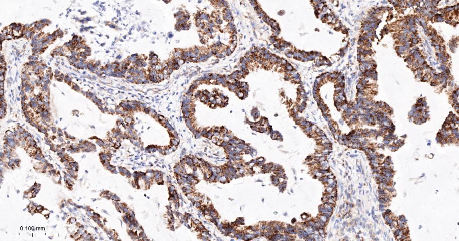 线粒体外膜受体Tom20重组兔单抗