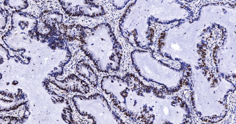 周期素E重组兔单抗