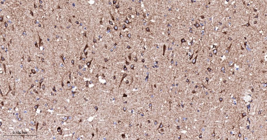 细胞色素c氧化酶亚型2重组兔单抗-bsm-52542R