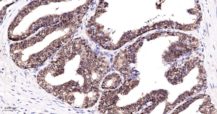 抑凋亡基因bag1重组兔单抗