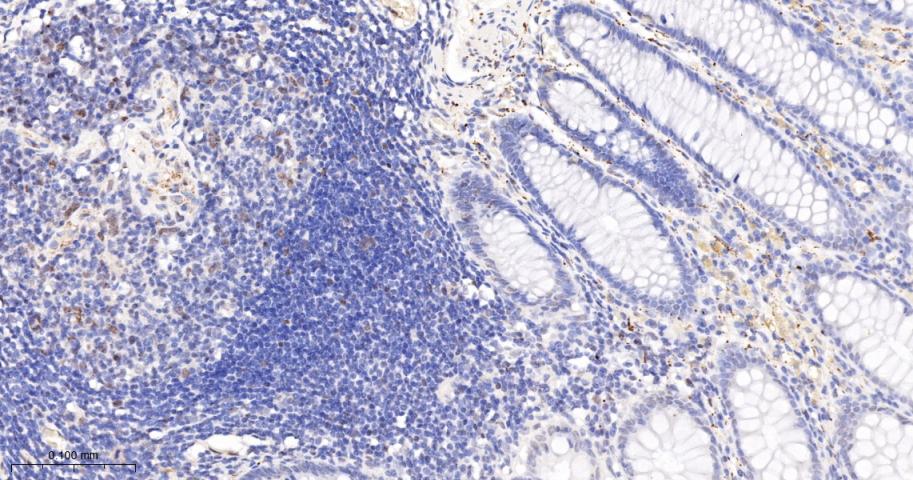 磷酸化ATM(Ser1981)重组兔单抗