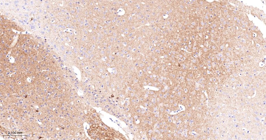 α横纹肌辅肌动蛋白重组兔单克隆抗体