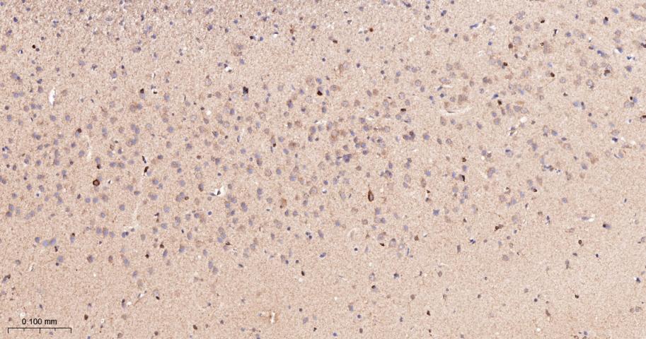 前列腺素氧化环化酶1重组兔单抗