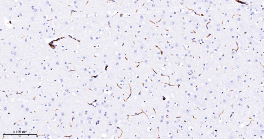 细胞间粘附分子-2（CD102）重组兔单抗