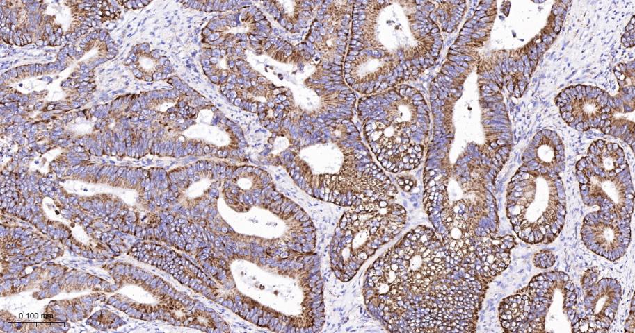 细胞色素c氧化酶亚型2重组兔单抗-bsm-52542R