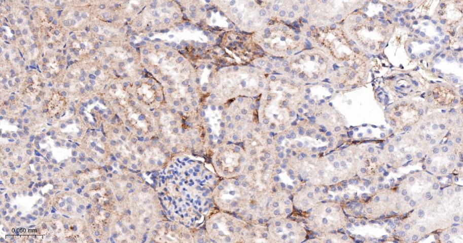 四连接素TN重组兔单抗