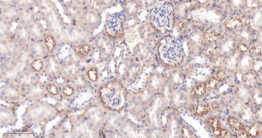 四连接素TN重组兔单抗