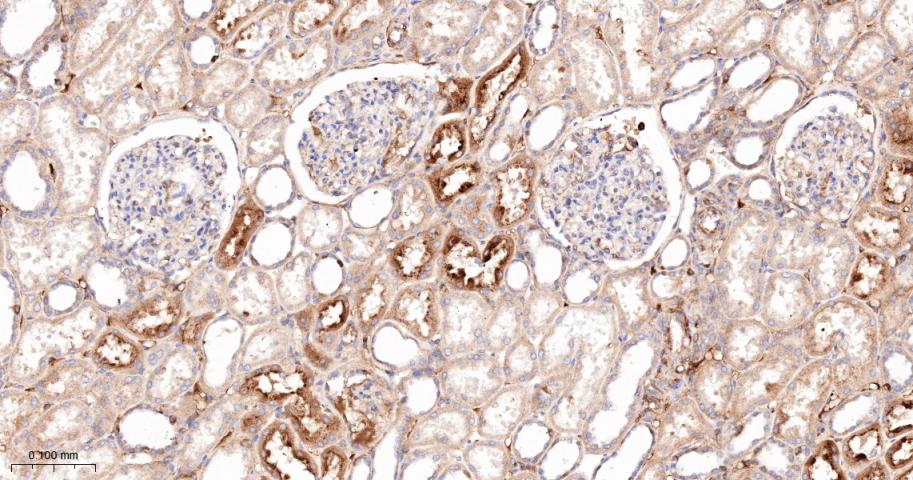 四连接素TN重组兔单抗