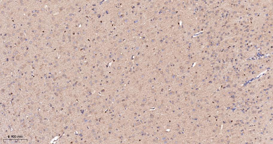 前列腺素氧化环化酶1重组兔单抗