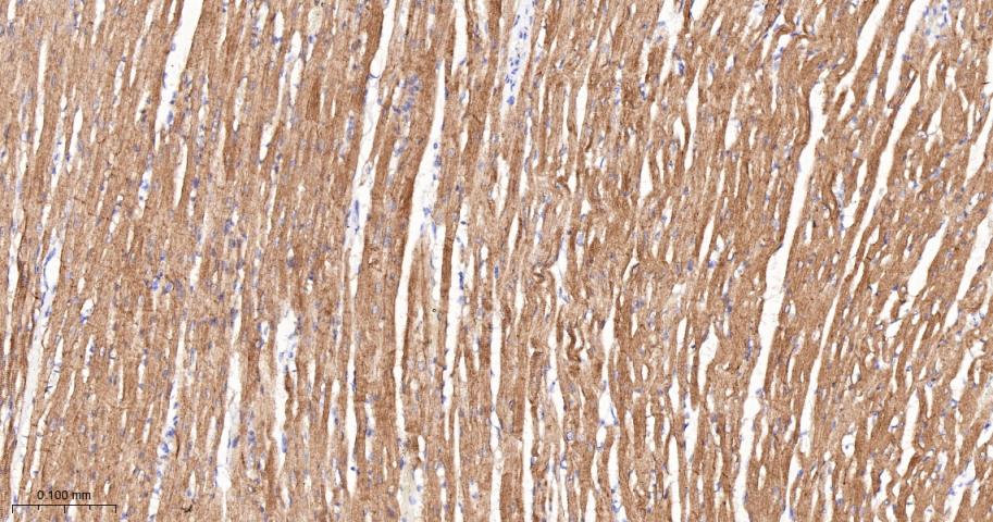 α横纹肌辅肌动蛋白重组兔单克隆抗体
