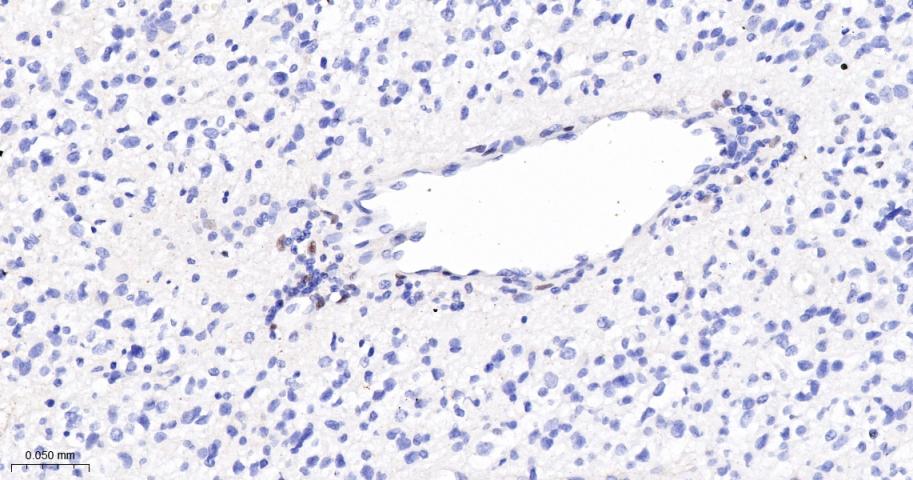 肿瘤抑制基因p63单克隆抗体