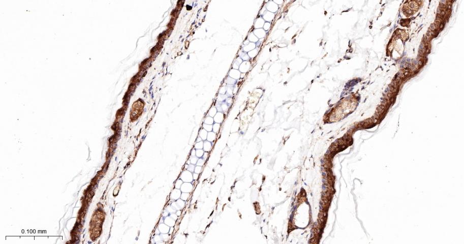 前列腺素氧化环化酶1重组兔单抗