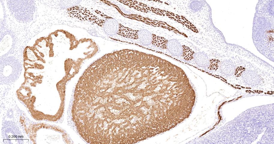 α横纹肌辅肌动蛋白重组兔单克隆抗体