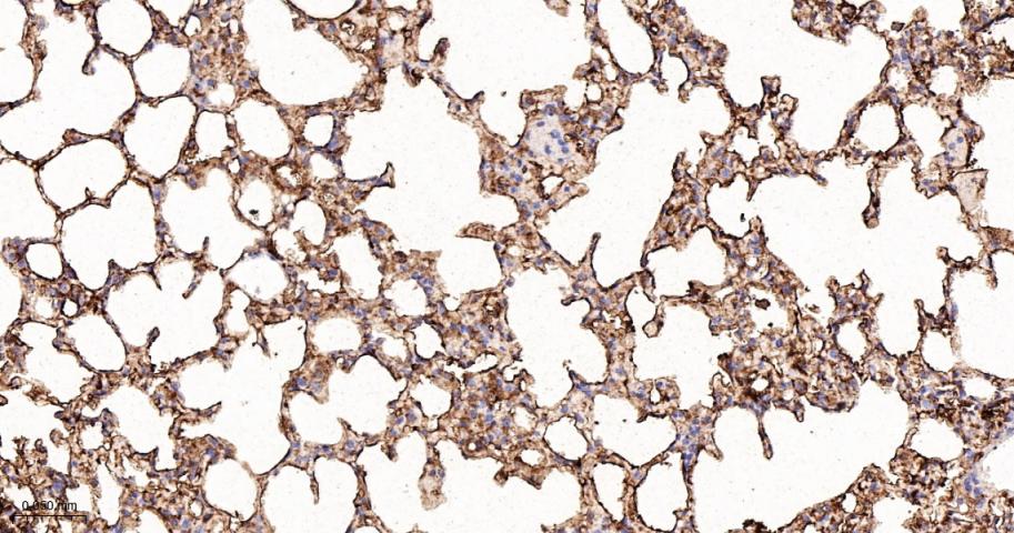 四连接素TN重组兔单抗