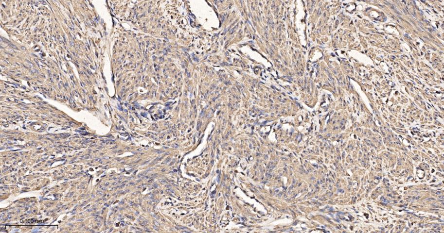 β-肌动蛋白（内参抗体）重组兔单抗