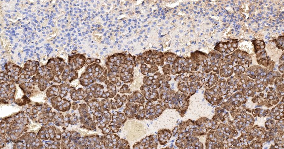 四连接素TN重组兔单抗