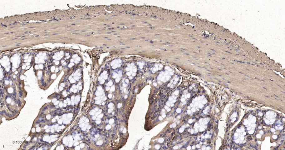 β-肌动蛋白（内参抗体）重组兔单抗