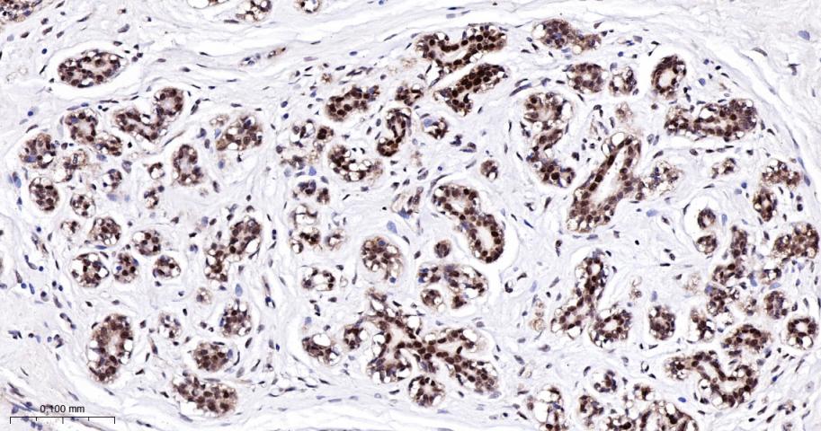 抑凋亡基因bag1重组兔单抗