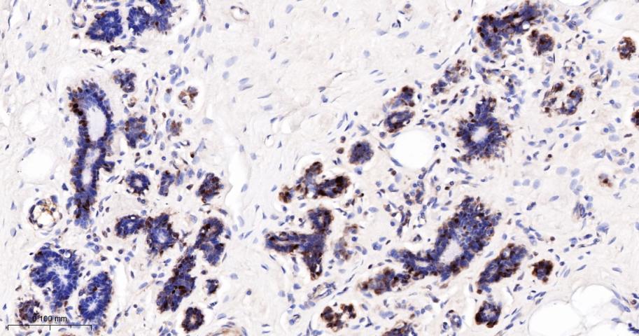 抑凋亡基因bag1重组兔单抗