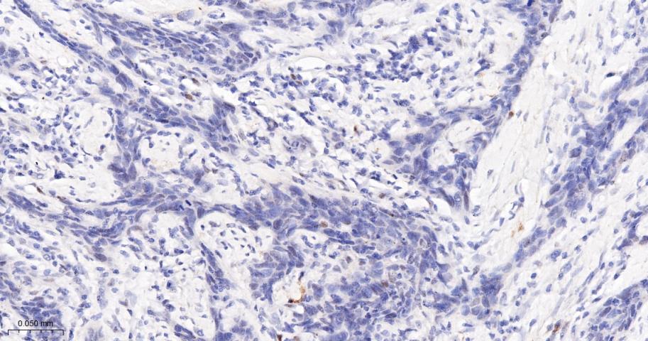 磷酸化ATM(Ser1981)重组兔单抗