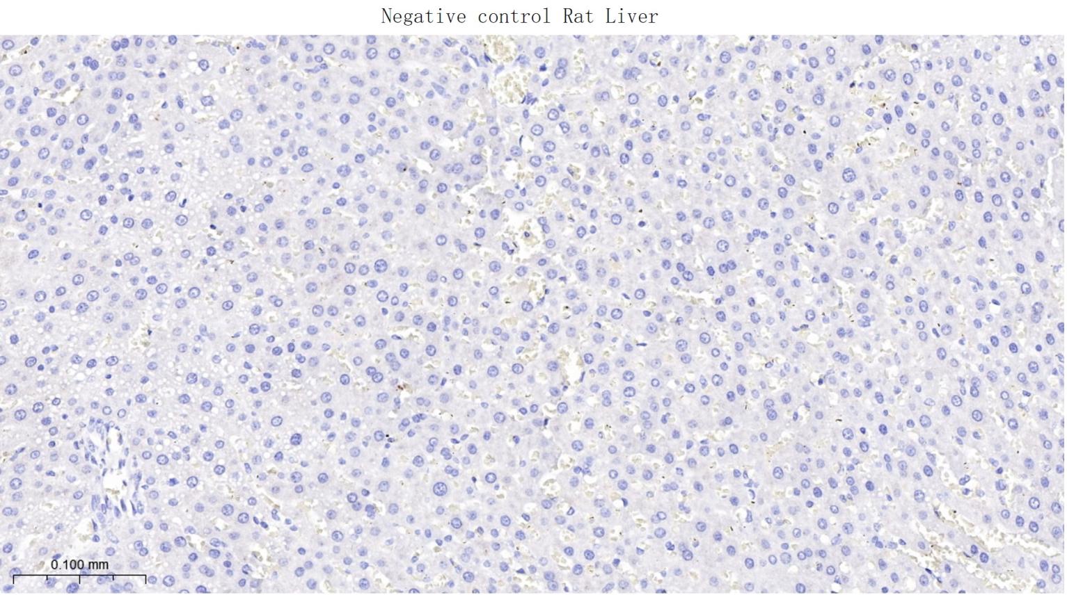 α横纹肌辅肌动蛋白重组兔单克隆抗体