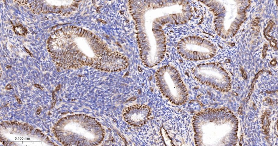 花生四烯酸15脂氧合酶1重组兔单抗-bsm-60930R