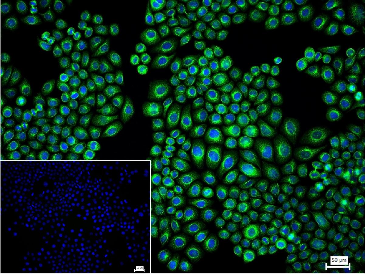 蛋白激酶AKT底物1重组兔单抗-bsm-61149R