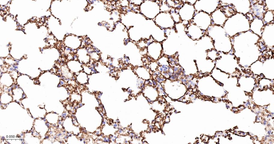 细胞间粘附分子-2（CD102）重组兔单抗