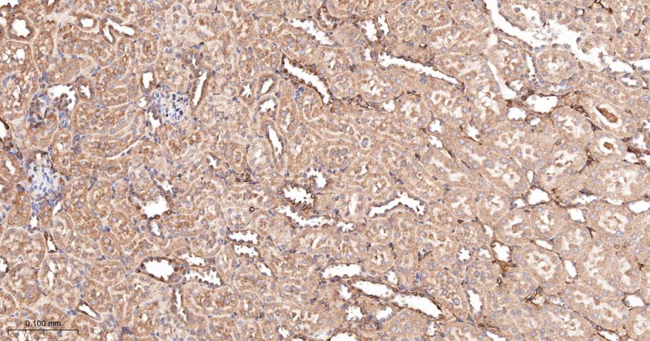 前列腺素氧化环化酶1重组兔单抗