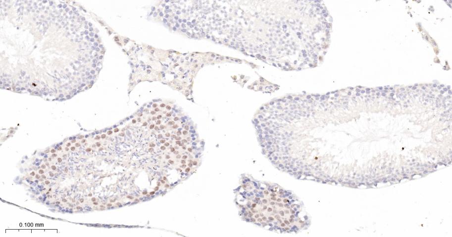 p21蛋白重组兔单抗