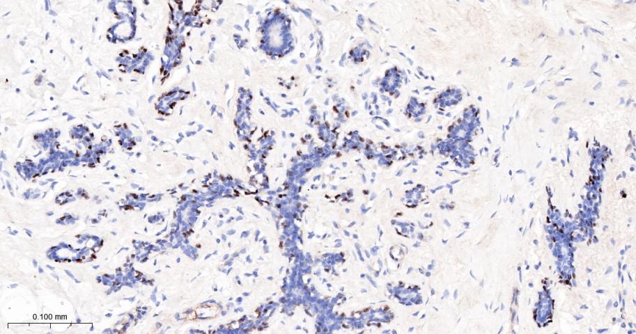 肿瘤抑制基因p63单克隆抗体