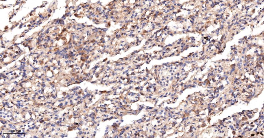 四连接素TN重组兔单抗