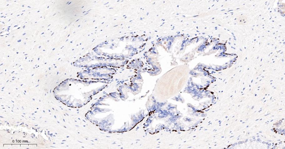 肿瘤抑制基因p63单克隆抗体
