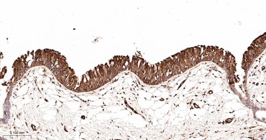 花生四烯酸15脂氧合酶1重组兔单抗-bsm-60930R